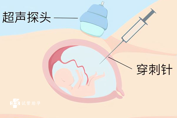 羊水穿刺的作用有很多，远不止鉴定胎儿性别这一种