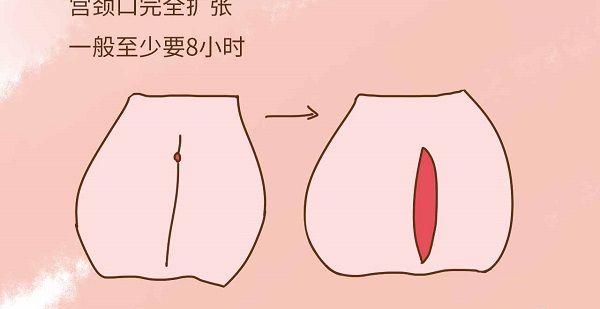 剧烈运动可致宫颈扩张