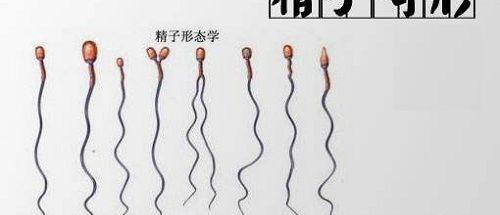 治疗精子畸形的偏方