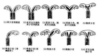 做宫腔镜需要多少钱,宫腔镜检查什么