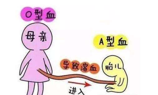 夫妻双方尿酸高可能会遗传给小孩尿酸高吗？预防和治疗措施？