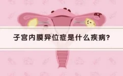 女性在排卵期出血是什么原因造成的？