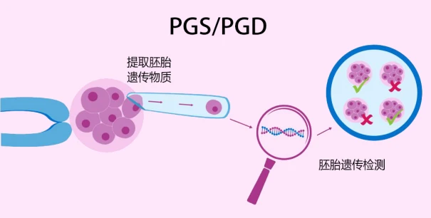 贵阳市妇幼保健院试管婴儿怎么样