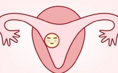 囊胚移植第10天出现宫外孕的征兆有哪些？