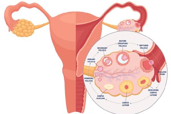 为什么子宫内膜异位症会引起痛经？