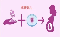 广州试管生双生胎的价格高吗，国内三代试管生双胎的条件及费用参考