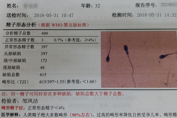 四川省人民医院人工授精费用多少