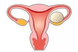 女人切掉一边输卵管有啥影响？略微降低怀孕几率
