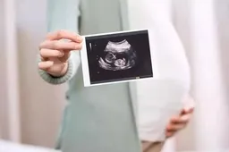试管婴儿nt后除了两种情况外可以不用黄体支持了