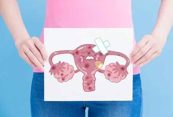 女性要如何自查是否出现了卵巢癌呢?