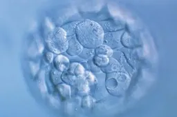 试管婴儿养囊胚成功率高吗？关注下养囊胚的优点