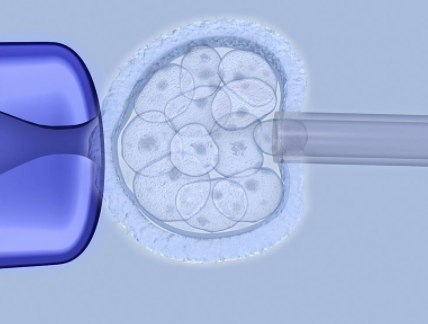 子宫内膜复杂性增生的治疗方法是什么？是否能治好？
