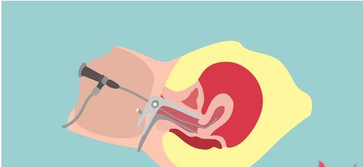 试管婴儿前宫腔镜检查的费用高吗，宫腔镜检查的必要性