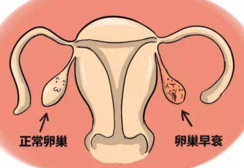 卵巢早衰成为女性间常见的疾病之一，出现的原因你都了解过吗？