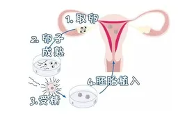 试管婴儿移植囊胚后左侧卵巢疼会是宫外孕吗，常见问题分析
