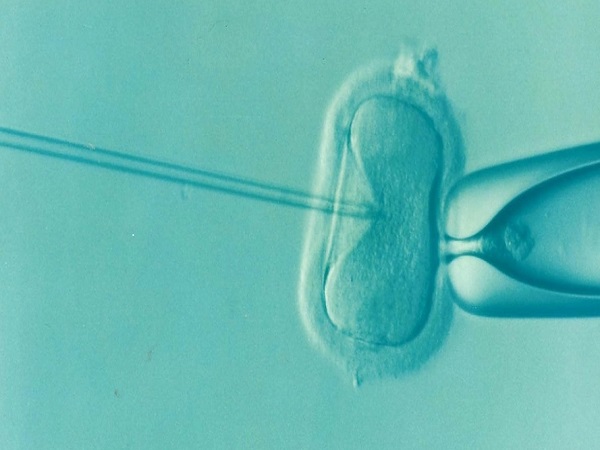 衡水地区有哪些私立的机构可以做试管技术?试管微刺激方案取出卵后到移植胚胎的周期要3天时间吗?