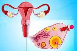 卵巢功能好为什么还选择拮抗剂方案?