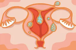 子宫囊肿与子宫肌瘤有什么不同  三代试管科普