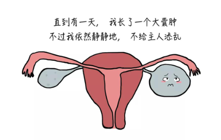 卵巢囊肿的照片：卵巢囊肿照片ct?