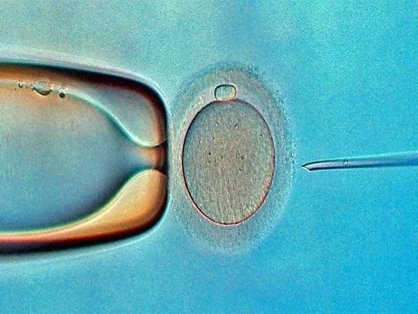 试管婴儿一般移植几个胚胎？可以要求双胎吗？