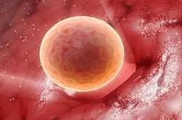 多囊卵巢综合征试管怎样取卵 保胎有什么秘诀