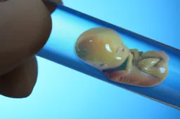 优先移植两个冻胚还是一个囊胚看要不要双胞胎?