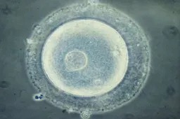 三代试管婴儿养囊是什么意思 哪些人适合囊胚培养