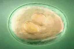胚胎移植后失败是选择再次移植还是重新取卵?