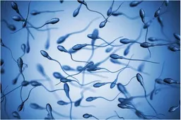 精子质量影响着试管移植结果，提高精子质量的三个妙招不容错过
