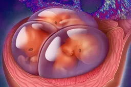 高级胚胎在试管移植中更具优势，根据自己情况选择最重要