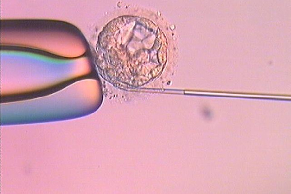 促排卵是三代试管中重要的步骤，在宜昌做试管促排要经历这些流程