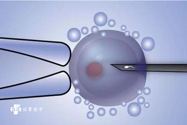 三代试管详细流程已公布，看完就知需要多长时间