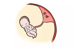 子宫卵巢囊肿是什么：子宫卵巢囊肿是什么样子的?