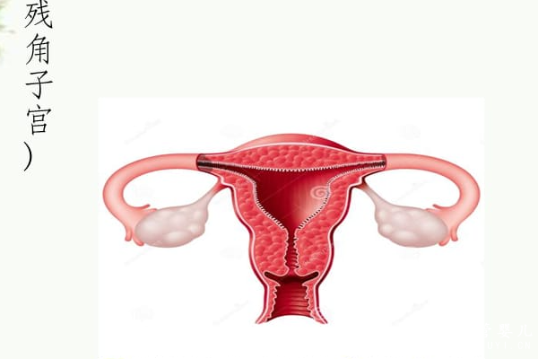 残角子宫可以通过做试管怀孕吗？理论上可以但需注意这些事项