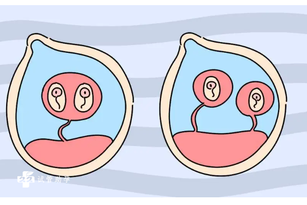 枣庄三代试管可以生双胞胎吗，这些风险需要注意