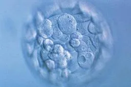 做试管婴儿的流程步骤解析，取卵受精后就能移植！