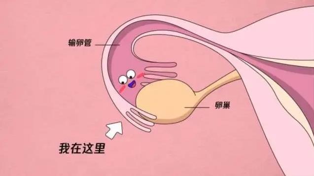 输卵管近端堵塞要怎么治疗