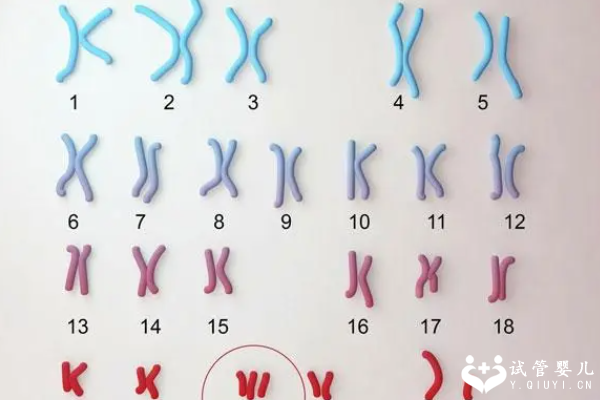 做试管婴儿必须要查染色体吗？医生：染色体检查有这些好处