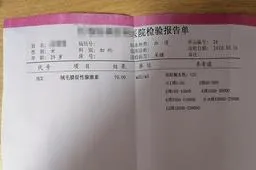 卵巢衰老的表现和原因是什么-卵巢早衰最佳恢复方法