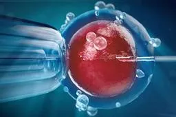 输卵管造影手术步骤及过程-做输卵管造影的详细流程