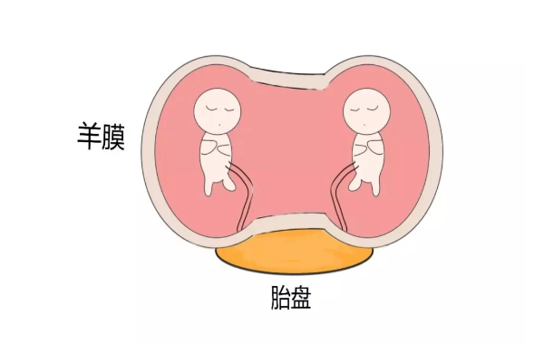 羊膜囊怀孕的早期症状是什么，这些保胎方法可帮你减少风险