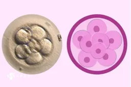 试管婴儿四级胚胎如何移植，移植后的注意事项要看好