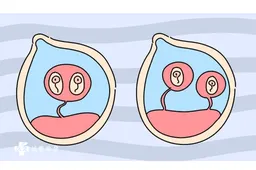 试管婴儿生双胞胎的几率大吗，多胎妊娠会出现这些风险