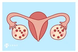 患有多囊卵巢能做试管吗，这些方法可提高受孕率