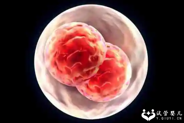 试管婴儿胚胎质量差是怎么回事？可能是这些原因在搞鬼
