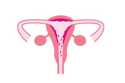 没有子宫如何实现怀孕，这些辅助生殖技术帮您解决问题