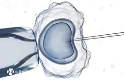 马来西亚试管婴儿步骤介绍，胚胎移植和后续观察事项供参考