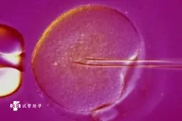 试管婴儿步骤介绍，胚胎放入子宫需要经过这几步