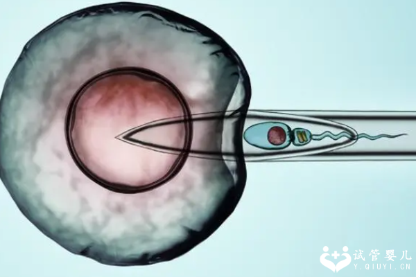 国内三代试管技术安全吗，想做试管婴儿的家庭速看