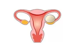 分析女性AMH值偏低的原因，卵巢功能衰退是常见影响因素